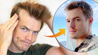 How I Stopped My Receding Hairline (Men