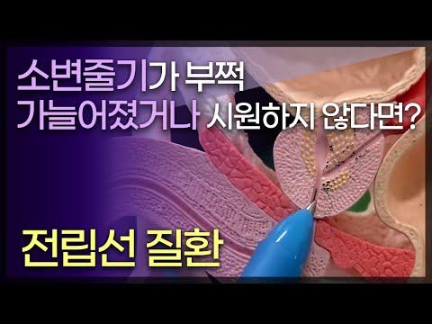 영상 썸네일