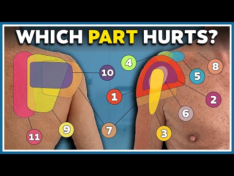 My shoulder hurts here! 12 most common pain locations and what they mean