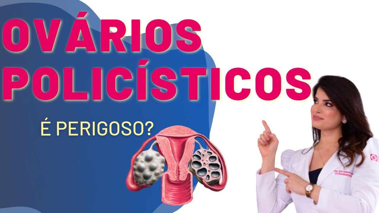 Ovários Policísticos: Sintomas, diagnóstico e tratamento | Dra. Roberta Gomes