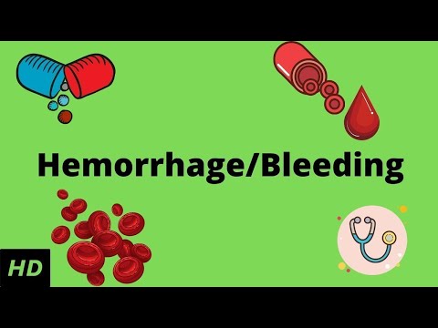 image-How can you tell if you have internal bleeding? 
