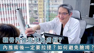 [討論] 減少顴骨內推下垂的方法