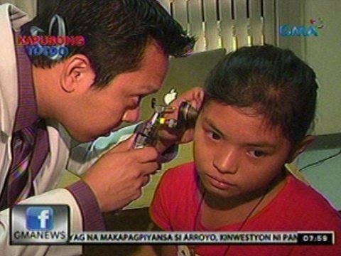 Asawa kapansin-pansing thinner Ay nangangahulugan upang alisin ang taba mula sa tiyan