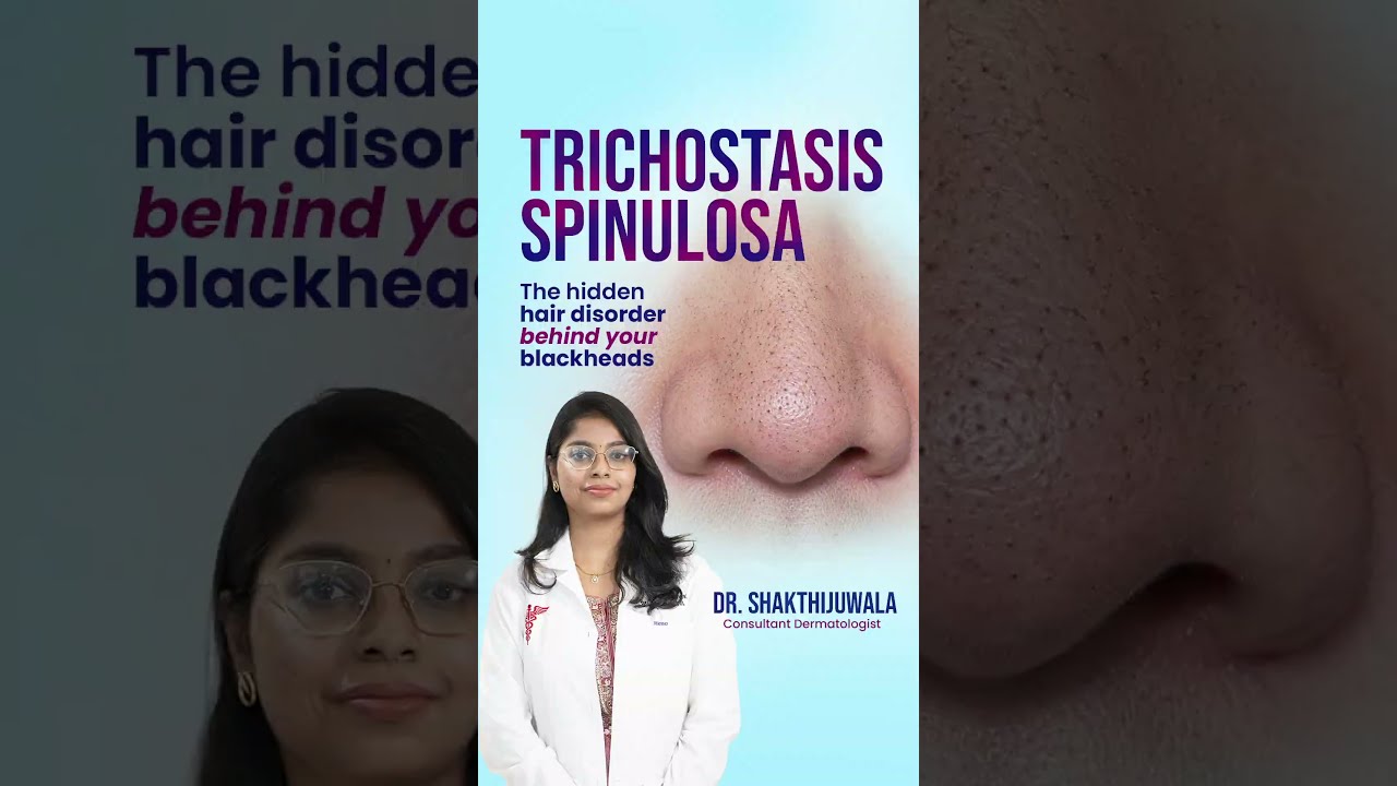Trichostasis Spinulosa: Causes, Symptoms & Treatment #dermatologyfacts #skincare