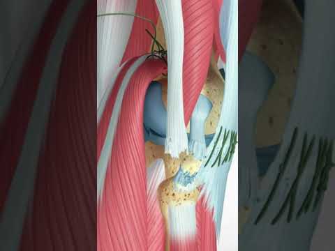 Guess The Spine Injury And Procedure Challenge