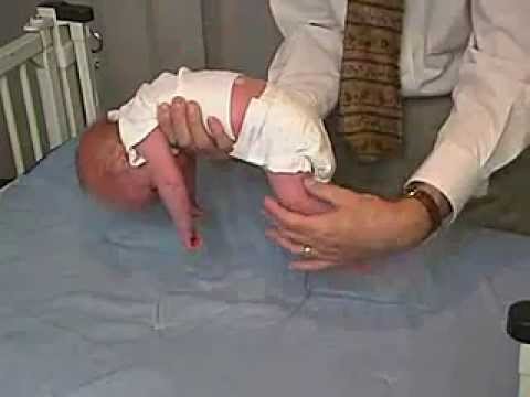 11/23. Clinical Pediatrics:  Hypotonia 5