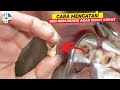 HOW TO TREAT CAVITIES SO THEY FALL OUT QUICKLY Ll DO THIS