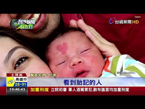 額頭有紅色胎記