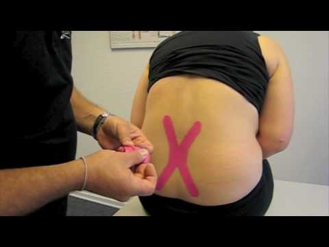 comment appliquer kinesio tape