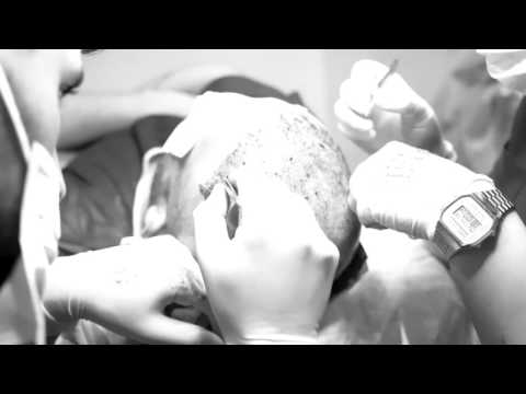 Aysel Ellialtı Misafirimize Saç Ekimi Yapılıyor.