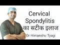 Cervical Spondylitis का सटीक इलाज