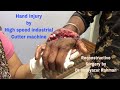 Hand Surgery Microsurgery Vascular Surgery Tendon Surgery Plastic Surgery Trauma