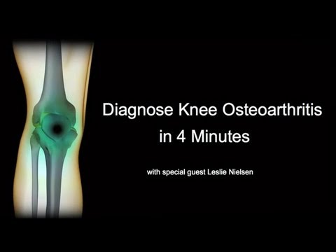 Osteoarthritis 2 3 szakasz