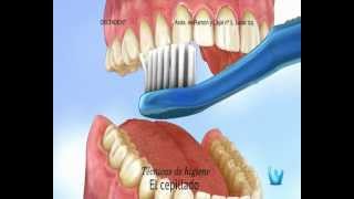 La higiene dental. DeltaDent Implantes dentales en Madrid