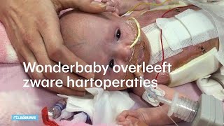 Wonderbaby met hart buiten lichaam overleeft zware operatie