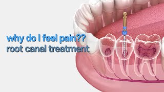 I&#39;ve got root canal treatment but why do I still feel pain?