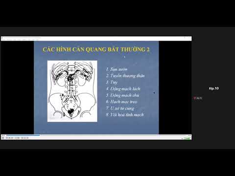 CĐHA thăm khám hệ Tiết niệu p2