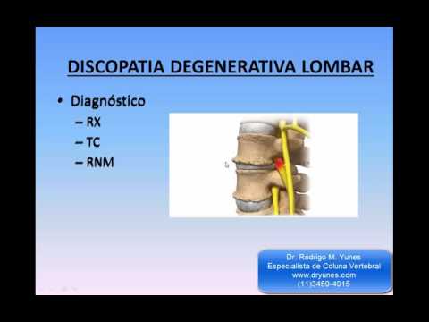 Se una persona ha un mal di hip Brace semirigida sullarticolazione del ginocchio