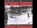 Broken Bones - Random