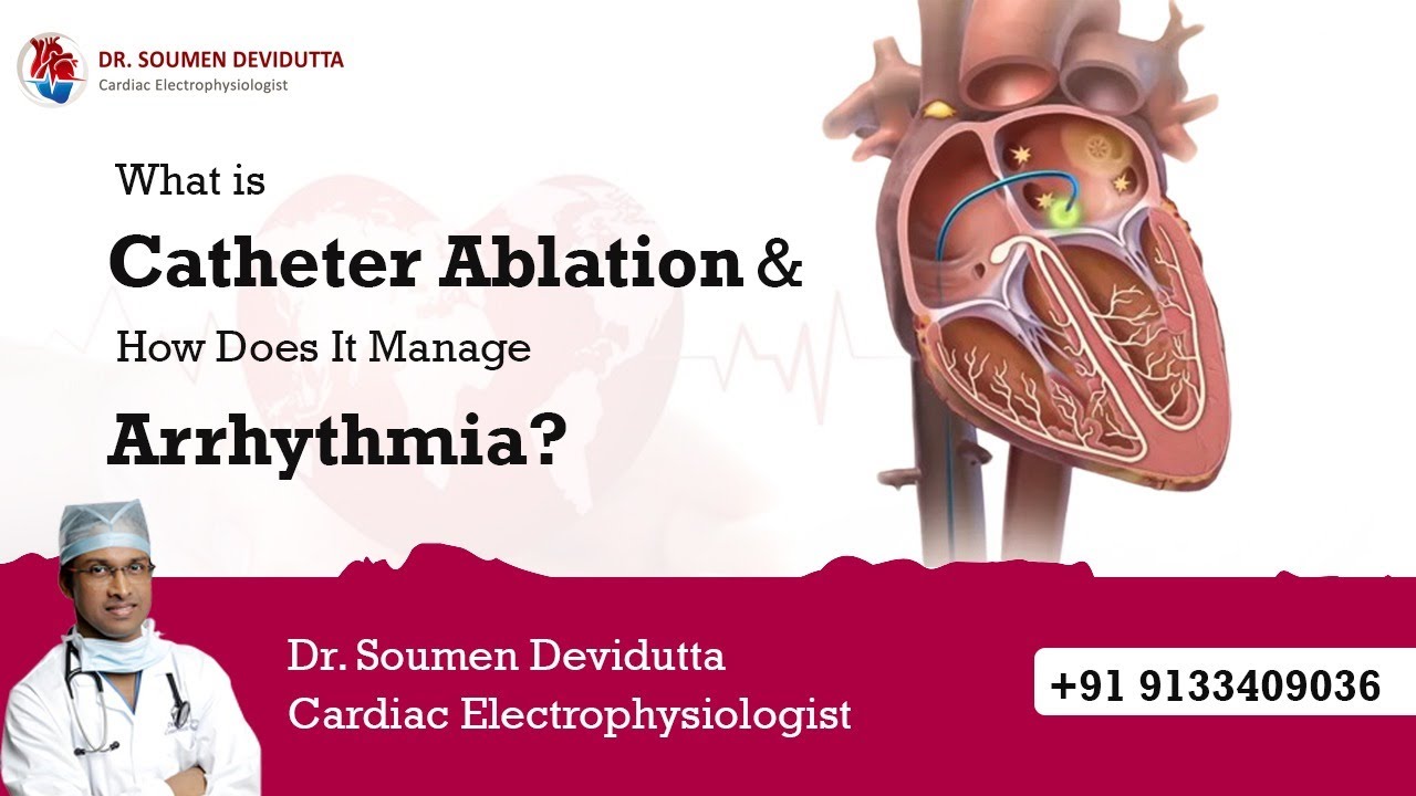 Catheter Ablation for Arrhythmia | How It Works & Benefits Explained | Dr Soumen Devidutta