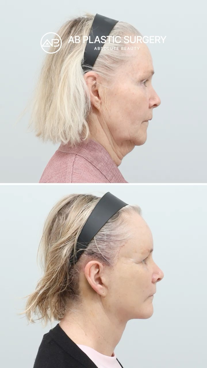 Her Transformation Journey