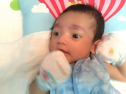 แปลงครีมในโรคสะเก็ดเงิน โลชั่นโรคสะเก็ดเงินของ celandine