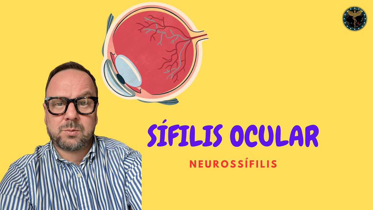 Sífilis Ocular, uma forma de Neurossífilis - Renato Cassol Médico Infectologista