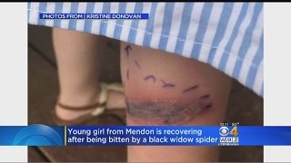 5-Year-Old Mendon Girl Recovering After Black Widow Spider Bite