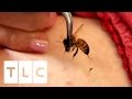 15 Bee Stings A Day My Strange Addiction