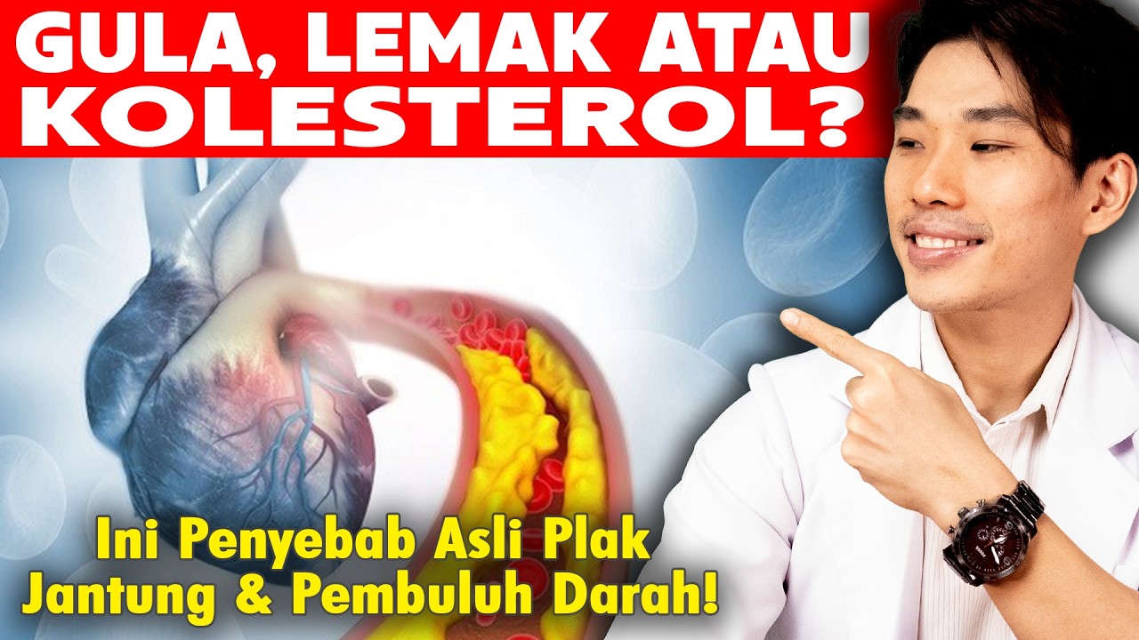 Plak Pembuluh Darah Terbentuk Karena Gula, Lemak atau Kolesterol?