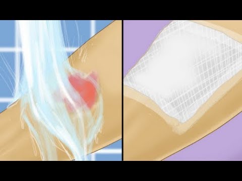 Da lentiggini e pigmentary nota in una farmacia per comprare la crema Crema di decolorazione efficace intorno a occhi