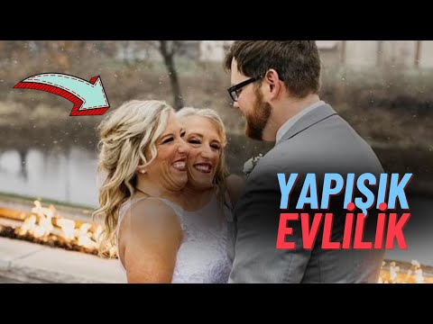 YAPIŞIK İKİZLER EVLENDİ ! DAMAT ŞOK YAŞADI