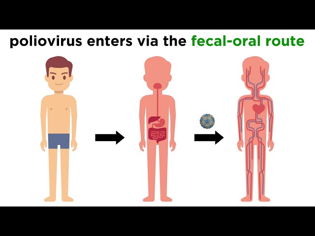 Video Uitspraak van polio in Engels