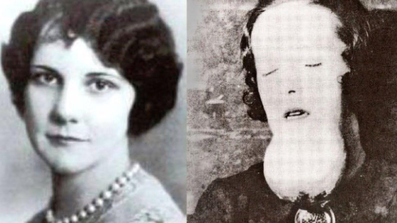 Dijeron que había muerto de sífilis. Pero cuando abrieron el ataúd...