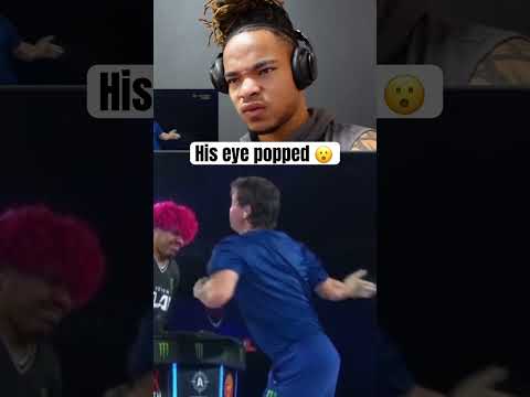 His eye popped after this slap 😮