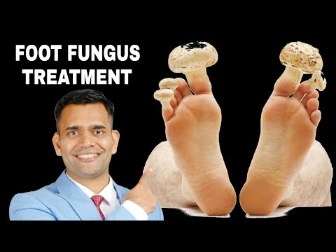 Foot Fungus & Bad Smell Gone in 7 Days | Simple Home Remedies That Really Work