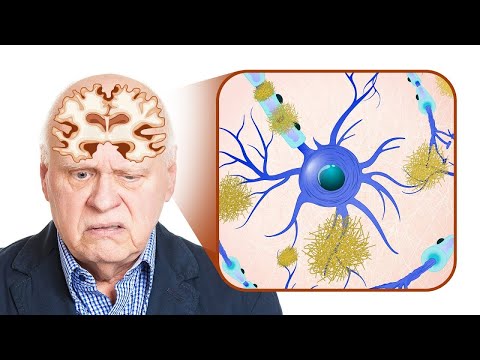 What is MTHFR – Dr Berg Explains in Simple Terms