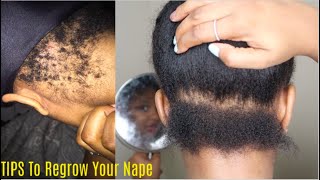 HOW TO REGROW YOUR NAPE HAIR/EDGES| *HIGHLY REQUESTED*