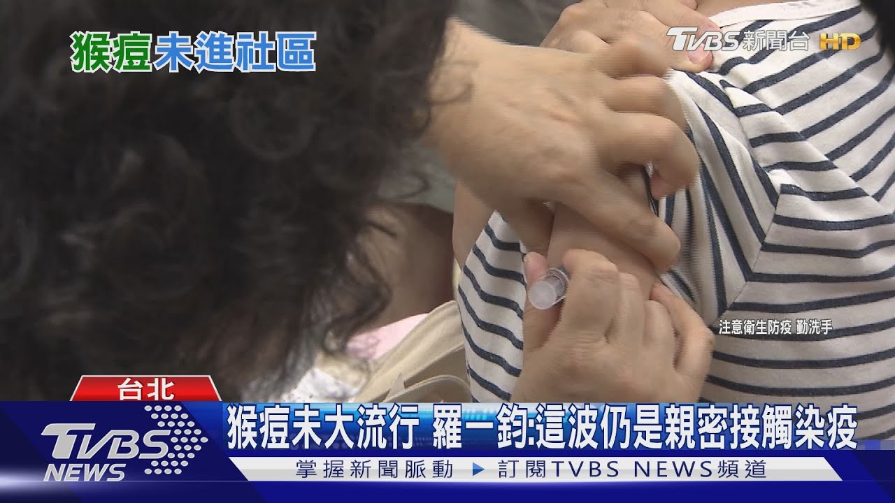 網傳「外籍女染猴痘」是假的 王必勝:轉傳恐觸法