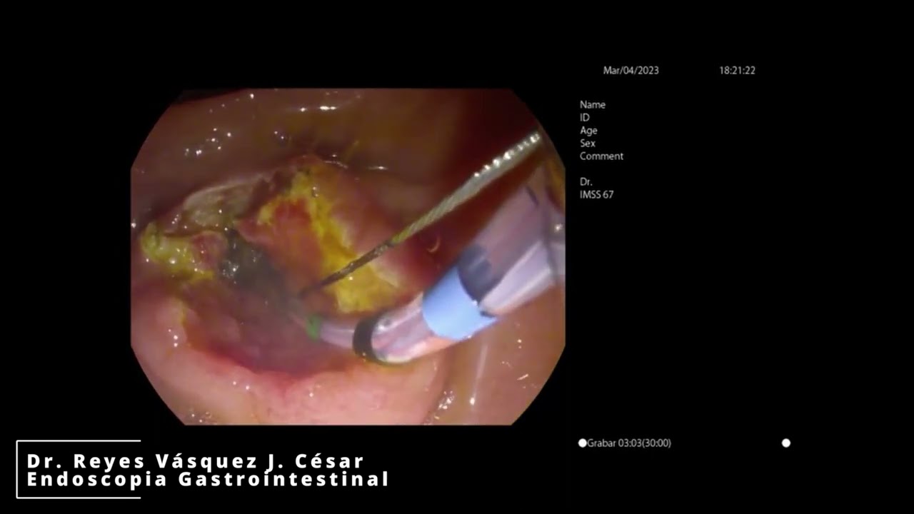 J. César Reyes Vásquez-40