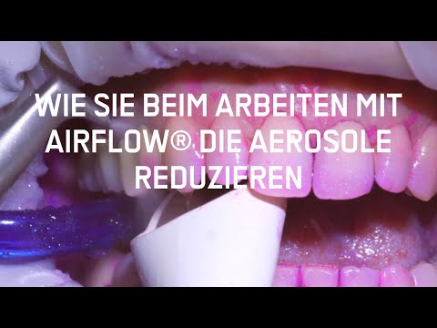 Wie Sie beim Arbeiten mit AIRFLOW® die Aerosole reduzieren