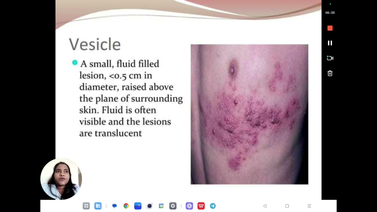 General clinical signs and pathomorphology of dermatoses, primary and secondary morphological rashes