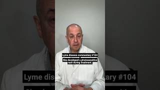 Doxycycline Warning: Lyme Disease and Sunburn Risk