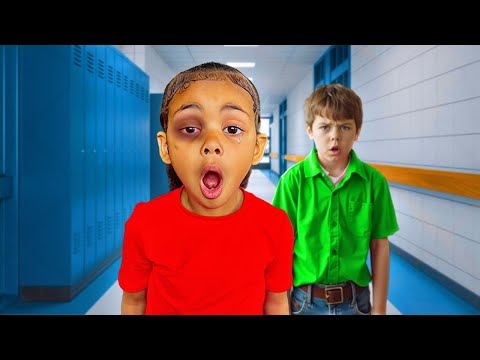 LYLAH GOT A BLACK EYE WHILE AT SCHOOL..💔