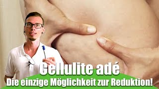 Cellulite adé - Der einzige Weg um Cellulite los zu werden!