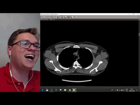 COMO AVALIAR UMA TOMOGRAFIA DO TÓRAX? Anatomia do Tórax e Sequência do que olhar | LIVE DE TC #2