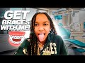 GET BRACES WITH ME
