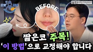 [성형외과 전문의 Q&A]  짧은코는 어떻게 교정하나요? /유형별 짧은코성형 해결방법