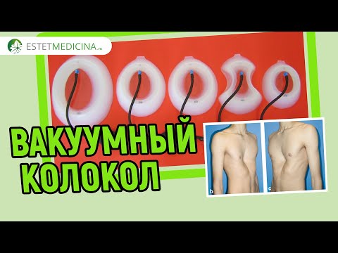 Воспаление локтевого сустава мазь Почему болят руки в плечевых суставах