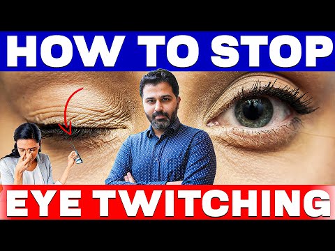 How To Stop Eye Twitching | What Causes Eye Twitching? | Get Rid of Eyelid Twitching